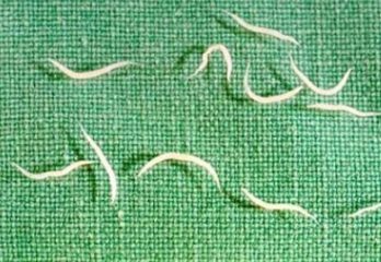 Фото: острицы