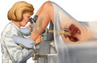 Кольпоскопия