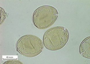 Фото: яйца широкого лентеца