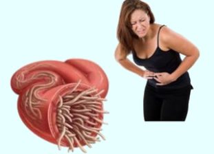 Как понять, есть ли у вас глисты?