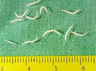 Фото: острицы