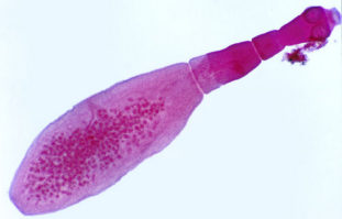 Фото: эхинококк