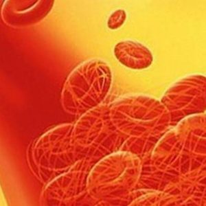 Васкулит симптомы фото Симптомы васкулита кожных покровов, фото