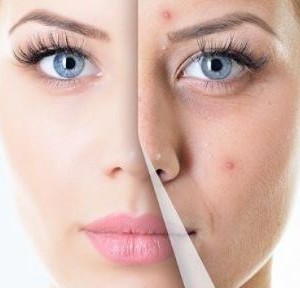 Профилактика от прыщей на лице Воспаленный прыщ на лице: как от него избавиться?