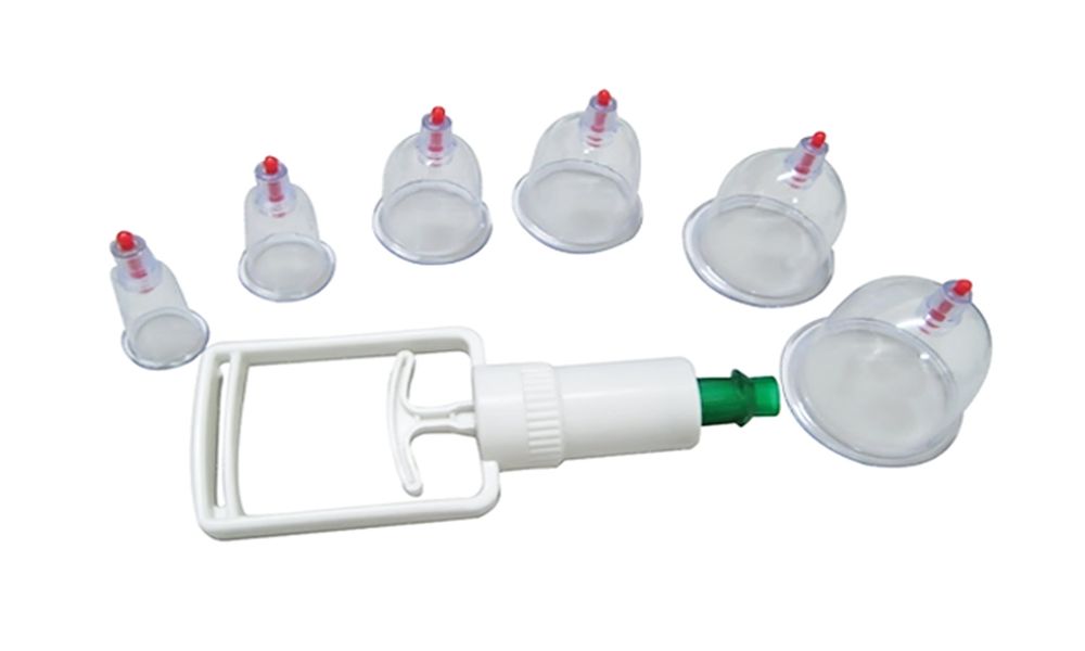 Кровопускание Хиджама при бесплодии и не только