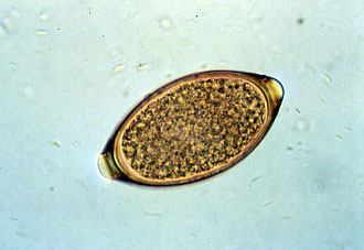 Фото: яйцо власоглава