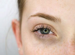 Фото: синяки под глазами