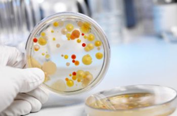 Посев на трихомонады