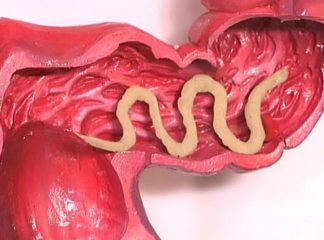 Глисты в кишечнике