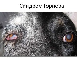 синдром бернара горнера