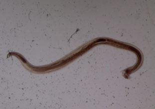 Фото: анкилостома