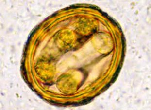 Яйцо аскариды