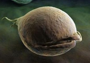 Трихомонада