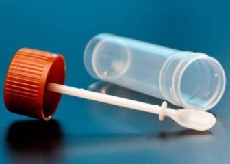 Анализ кала на яйца глист: роль в диагностике гельминтозов, когда и как сдавать