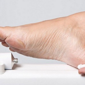 Лечение экземы ступней Появление посттравматической экземы на пятках и стопе