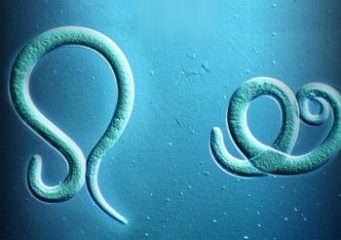 Фото: острицы